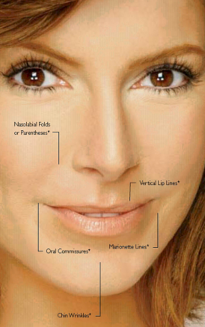 Juvederm Ultra & Juvederm Ultra Plus